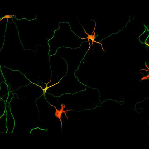  NCBI Organism:Rattus; Cell Types:multipolar neuron Cell Components:microtubule cytoskeleton, dendrite, axon; Biological process:dendrite development, establishment or maintenance of cell polarity;