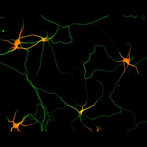  NCBI Organism:Rattus; Cell Types:multipolar neuron Cell Components:microtubule cytoskeleton, dendrite, axon; Biological process:dendrite development, establishment or maintenance of cell polarity;