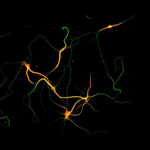  NCBI Organism:Rattus; Cell Types:multipolar neuron Cell Components:microtubule cytoskeleton, dendrite, axon; Biological process:dendrite development, establishment or maintenance of cell polarity;