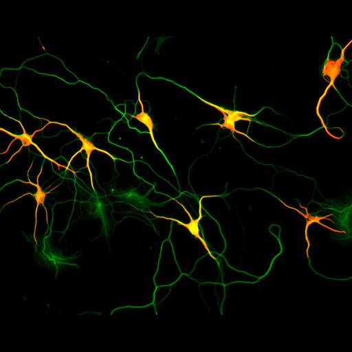  NCBI Organism:Rattus; Cell Types:multipolar neuron Cell Components:microtubule cytoskeleton, dendrite, axon; Biological process:dendrite development, establishment or maintenance of cell polarity;