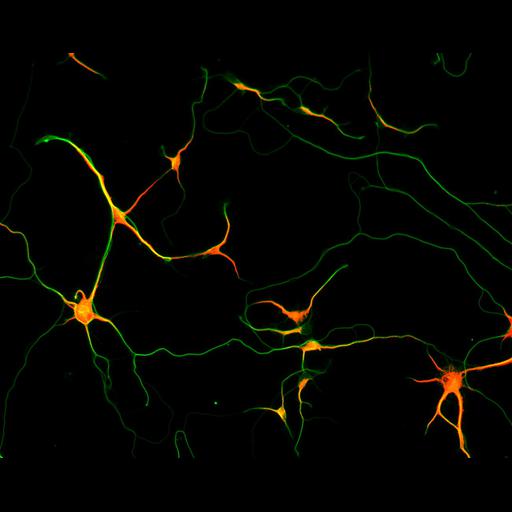  NCBI Organism:Rattus; Cell Types:multipolar neuron Cell Components:microtubule cytoskeleton, dendrite, axon; Biological process:dendrite development, establishment or maintenance of cell polarity;