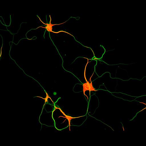  NCBI Organism:Rattus; Cell Types:multipolar neuron Cell Components:microtubule cytoskeleton, dendrite, axon; Biological process:dendrite development, establishment or maintenance of cell polarity;