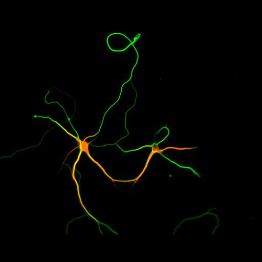  NCBI Organism:Rattus; Cell Types:multipolar neuron Cell Components:microtubule cytoskeleton, dendrite, axon; Biological process:dendrite development, establishment or maintenance of cell polarity;