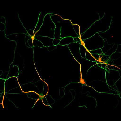  NCBI Organism:Rattus; Cell Types:multipolar neuron Cell Components:microtubule cytoskeleton, dendrite, axon; Biological process:dendrite development, establishment or maintenance of cell polarity;