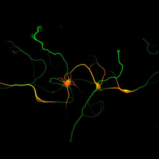  NCBI Organism:Rattus; Cell Types:multipolar neuron Cell Components:microtubule cytoskeleton, dendrite, axon; Biological process:dendrite development, establishment or maintenance of cell polarity;