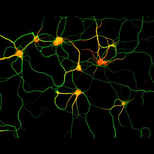  NCBI Organism:Rattus; Cell Types:multipolar neuron Cell Components:microtubule cytoskeleton, dendrite, axon; Biological process:dendrite development, establishment or maintenance of cell polarity;