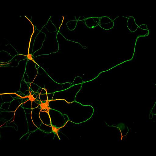  NCBI Organism:Rattus; Cell Types:multipolar neuron Cell Components:microtubule cytoskeleton, dendrite, axon; Biological process:dendrite development, establishment or maintenance of cell polarity;