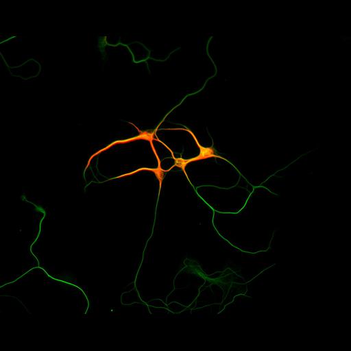  NCBI Organism:Rattus; Cell Types:multipolar neuron Cell Components:microtubule cytoskeleton, dendrite, axon; Biological process:dendrite development, establishment or maintenance of cell polarity;