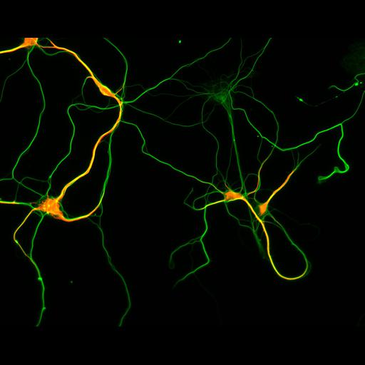  NCBI Organism:Rattus; Cell Types:multipolar neuron Cell Components:microtubule cytoskeleton, dendrite, axon; Biological process:dendrite development, establishment or maintenance of cell polarity;