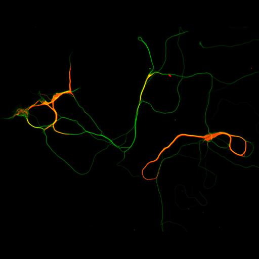  NCBI Organism:Rattus; Cell Types:multipolar neuron Cell Components:microtubule cytoskeleton, dendrite, axon; Biological process:dendrite development, establishment or maintenance of cell polarity;