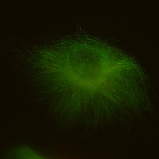  NCBI Organism:Homo sapiens; Cell Types:, epithelial cell; Cell Components:microtubule, cytoskeleton, protein complex; Biological process:protein polymerization