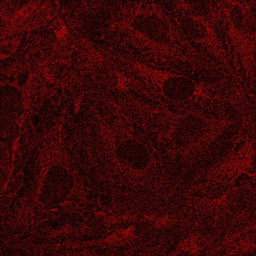  NCBI Organism:Homo sapiens; Cell Types:, epithelial cell; Cell Components:microtubule, cytoskeleton, Axin-APC-beta-catenin-GSK3B complex, protein complex; Biological process:protein polymerization, intracellular signal transduction, peptidyl-serine phosphorylation;