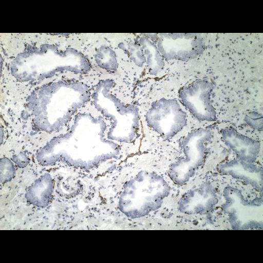  NCBI Organism:Homo sapiens; Cell Types:endocrine-paracrine cell of prostate gland, basal cell of prostate epithelium, luminal cell of prostate epithelium, blood vessel endothelial cell, perineural cell, sheath cell, leukocyte, prostate stromal cell, smooth muscle cell of prostate; Cell Components:nucleus, cell surface;