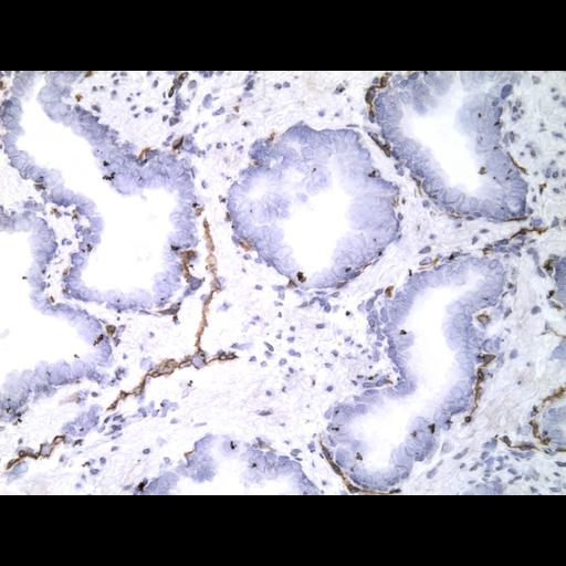  NCBI Organism:Homo sapiens; Cell Types:endocrine-paracrine cell of prostate gland, basal cell of prostate epithelium, luminal cell of prostate epithelium, blood vessel endothelial cell, perineural cell, sheath cell, leukocyte, prostate stromal cell, smooth muscle cell of prostate; Cell Components:nucleus, cell surface;