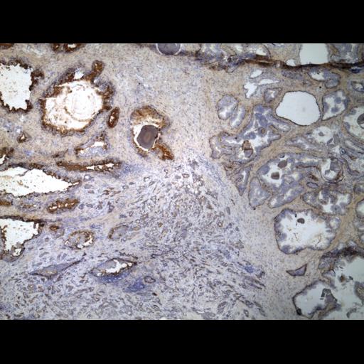  NCBI Organism:Homo sapiens; Cell Types:endocrine-paracrine cell of prostate gland, basal cell of prostate epithelium, luminal cell of prostate epithelium, blood vessel endothelial cell, perineural cell, sheath cell, leukocyte, prostate stromal cell, smooth muscle cell of prostate; Cell Components:nucleus, cell surface;