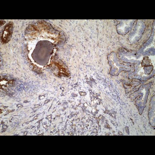  NCBI Organism:Homo sapiens; Cell Types:endocrine-paracrine cell of prostate gland, basal cell of prostate epithelium, luminal cell of prostate epithelium, blood vessel endothelial cell, perineural cell, sheath cell, leukocyte, prostate stromal cell, smooth muscle cell of prostate; Cell Components:nucleus, cell surface;