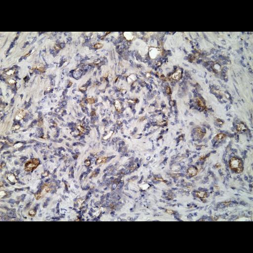  NCBI Organism:Homo sapiens; Cell Types:endocrine-paracrine cell of prostate gland, basal cell of prostate epithelium, luminal cell of prostate epithelium, blood vessel endothelial cell, perineural cell, sheath cell, leukocyte, prostate stromal cell, smooth muscle cell of prostate; Cell Components:nucleus, cell surface;