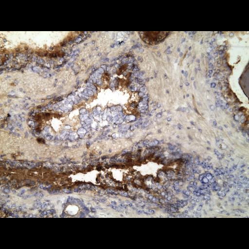  NCBI Organism:Homo sapiens; Cell Types:endocrine-paracrine cell of prostate gland, basal cell of prostate epithelium, luminal cell of prostate epithelium, blood vessel endothelial cell, perineural cell, sheath cell, leukocyte, prostate stromal cell, smooth muscle cell of prostate; Cell Components:nucleus, cell surface;