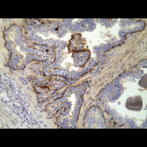  NCBI Organism:Homo sapiens; Cell Types:endocrine-paracrine cell of prostate gland, basal cell of prostate epithelium, luminal cell of prostate epithelium, blood vessel endothelial cell, perineural cell, sheath cell, leukocyte, prostate stromal cell, smooth muscle cell of prostate; Cell Components:nucleus, cell surface;