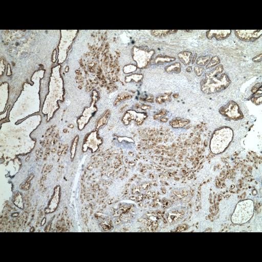  NCBI Organism:Homo sapiens; Cell Types:endocrine-paracrine cell of prostate gland, basal cell of prostate epithelium, luminal cell of prostate epithelium, blood vessel endothelial cell, perineural cell, sheath cell, leukocyte, prostate stromal cell, smooth muscle cell of prostate; Cell Components:nucleus, cell surface;