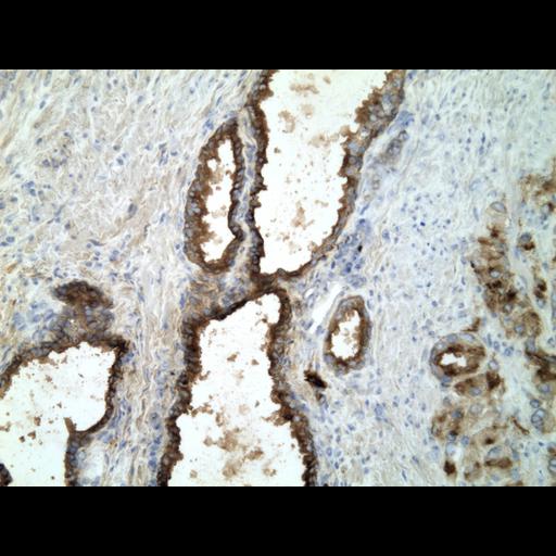  NCBI Organism:Homo sapiens; Cell Types:endocrine-paracrine cell of prostate gland, basal cell of prostate epithelium, luminal cell of prostate epithelium, blood vessel endothelial cell, perineural cell, sheath cell, leukocyte, prostate stromal cell, smooth muscle cell of prostate; Cell Components:nucleus, cell surface;