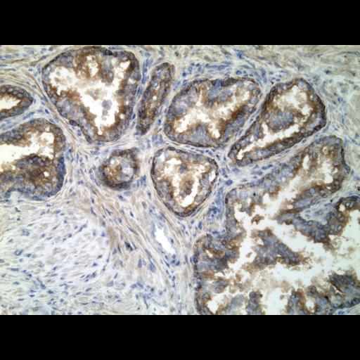  NCBI Organism:Homo sapiens; Cell Types:endocrine-paracrine cell of prostate gland, basal cell of prostate epithelium, luminal cell of prostate epithelium, blood vessel endothelial cell, perineural cell, sheath cell, leukocyte, prostate stromal cell, smooth muscle cell of prostate; Cell Components:nucleus, cell surface;