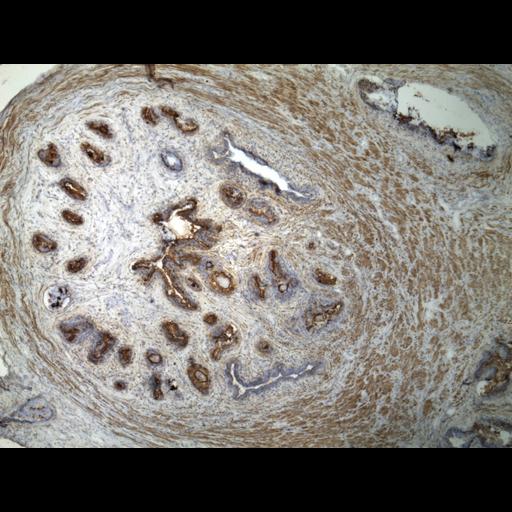  NCBI Organism:Homo sapiens; Cell Types:endocrine-paracrine cell of prostate gland, basal cell of prostate epithelium, luminal cell of prostate epithelium, blood vessel endothelial cell, perineural cell, sheath cell, leukocyte, prostate stromal cell, smooth muscle cell of prostate; Cell Components:nucleus, cell surface;