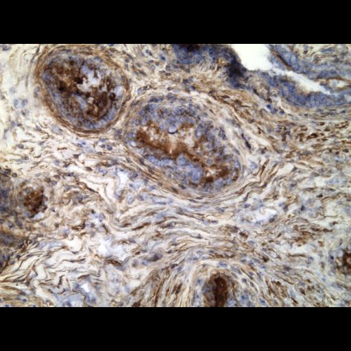  NCBI Organism:Homo sapiens; Cell Types:endocrine-paracrine cell of prostate gland, basal cell of prostate epithelium, luminal cell of prostate epithelium, blood vessel endothelial cell, perineural cell, sheath cell, leukocyte, prostate stromal cell, smooth muscle cell of prostate; Cell Components:nucleus, cell surface;