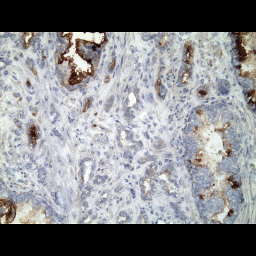  NCBI Organism:Homo sapiens; Cell Types:endocrine-paracrine cell of prostate gland, basal cell of prostate epithelium, luminal cell of prostate epithelium, blood vessel endothelial cell, perineural cell, sheath cell, leukocyte, prostate stromal cell, smooth muscle cell of prostate; Cell Components:nucleus, cell surface;