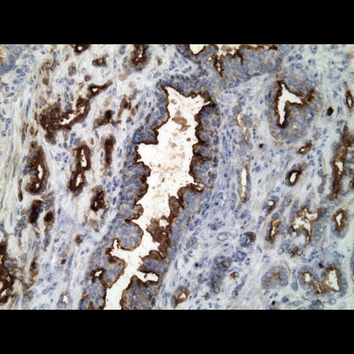  NCBI Organism:Homo sapiens; Cell Types:endocrine-paracrine cell of prostate gland, basal cell of prostate epithelium, luminal cell of prostate epithelium, blood vessel endothelial cell, perineural cell, sheath cell, leukocyte, prostate stromal cell, smooth muscle cell of prostate; Cell Components:nucleus, cell surface;