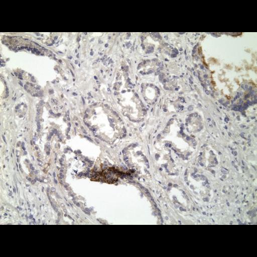  NCBI Organism:Homo sapiens; Cell Types:endocrine-paracrine cell of prostate gland, basal cell of prostate epithelium, luminal cell of prostate epithelium, blood vessel endothelial cell, perineural cell, sheath cell, leukocyte, prostate stromal cell, smooth muscle cell of prostate; Cell Components:nucleus, cell surface;