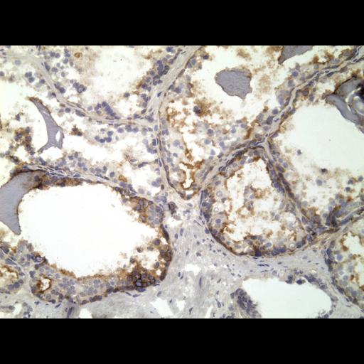  NCBI Organism:Homo sapiens; Cell Types:endocrine-paracrine cell of prostate gland, basal cell of prostate epithelium, luminal cell of prostate epithelium, blood vessel endothelial cell, perineural cell, sheath cell, leukocyte, prostate stromal cell, smooth muscle cell of prostate; Cell Components:nucleus, cell surface;