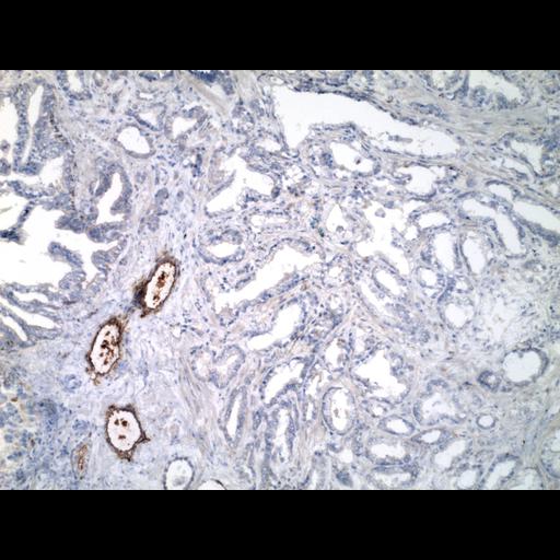  NCBI Organism:Homo sapiens; Cell Types:endocrine-paracrine cell of prostate gland, basal cell of prostate epithelium, luminal cell of prostate epithelium, blood vessel endothelial cell, perineural cell, sheath cell, leukocyte, prostate stromal cell, smooth muscle cell of prostate; Cell Components:nucleus, cell surface;