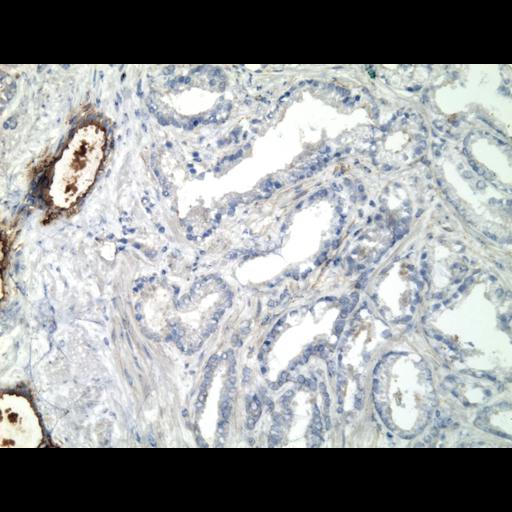  NCBI Organism:Homo sapiens; Cell Types:endocrine-paracrine cell of prostate gland, basal cell of prostate epithelium, luminal cell of prostate epithelium, blood vessel endothelial cell, perineural cell, sheath cell, leukocyte, prostate stromal cell, smooth muscle cell of prostate; Cell Components:nucleus, cell surface;