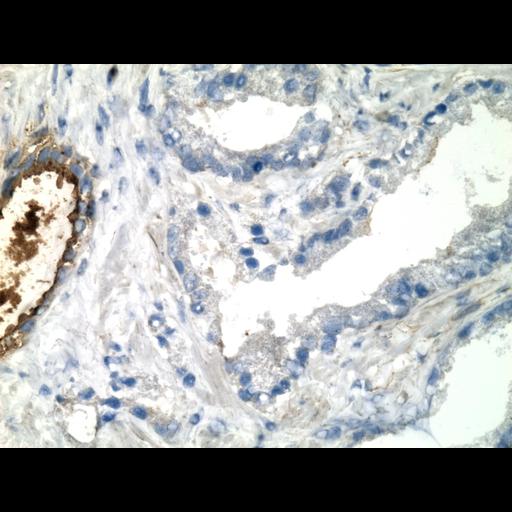  NCBI Organism:Homo sapiens; Cell Types:endocrine-paracrine cell of prostate gland, basal cell of prostate epithelium, luminal cell of prostate epithelium, blood vessel endothelial cell, perineural cell, sheath cell, leukocyte, prostate stromal cell, smooth muscle cell of prostate; Cell Components:nucleus, cell surface;