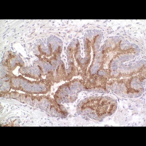  NCBI Organism:Homo sapiens; Cell Types:endocrine-paracrine cell of prostate gland, basal cell of prostate epithelium, luminal cell of prostate epithelium, blood vessel endothelial cell, perineural cell, sheath cell, leukocyte, prostate stromal cell, smooth muscle cell of prostate; Cell Components:nucleus, cell surface;