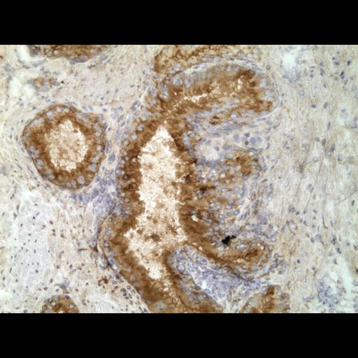  NCBI Organism:Homo sapiens; Cell Types:endocrine-paracrine cell of prostate gland, basal cell of prostate epithelium, luminal cell of prostate epithelium, blood vessel endothelial cell, perineural cell, sheath cell, leukocyte, prostate stromal cell, smooth muscle cell of prostate; Cell Components:nucleus, cell surface;