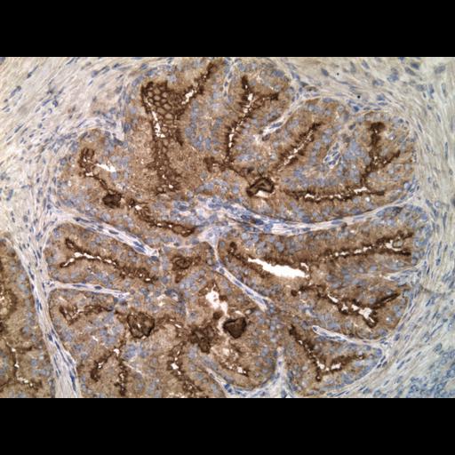  NCBI Organism:Homo sapiens; Cell Types:endocrine-paracrine cell of prostate gland, basal cell of prostate epithelium, luminal cell of prostate epithelium, blood vessel endothelial cell, perineural cell, sheath cell, leukocyte, prostate stromal cell, smooth muscle cell of prostate; Cell Components:nucleus, cell surface;