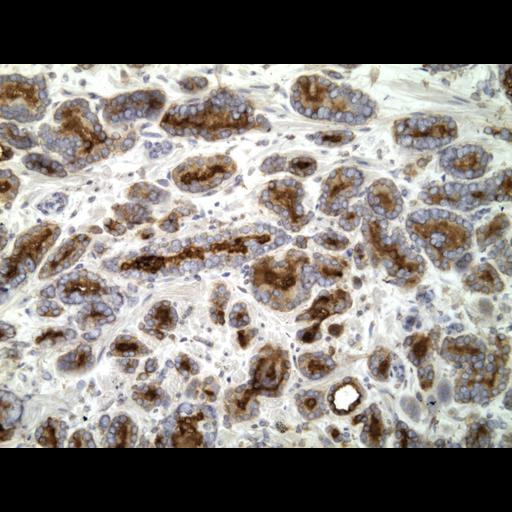  NCBI Organism:Homo sapiens; Cell Types:endocrine-paracrine cell of prostate gland, basal cell of prostate epithelium, luminal cell of prostate epithelium, blood vessel endothelial cell, perineural cell, sheath cell, leukocyte, prostate stromal cell, smooth muscle cell of prostate; Cell Components:nucleus, cell surface;