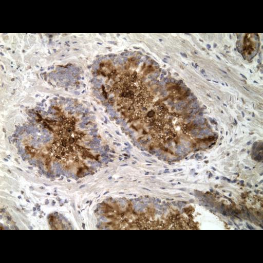  NCBI Organism:Homo sapiens; Cell Types:endocrine-paracrine cell of prostate gland, basal cell of prostate epithelium, luminal cell of prostate epithelium, blood vessel endothelial cell, perineural cell, sheath cell, leukocyte, prostate stromal cell, smooth muscle cell of prostate; Cell Components:nucleus, cell surface;