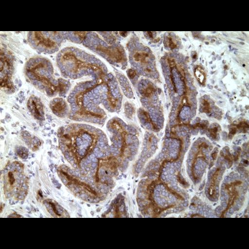  NCBI Organism:Homo sapiens; Cell Types:endocrine-paracrine cell of prostate gland, basal cell of prostate epithelium, luminal cell of prostate epithelium, blood vessel endothelial cell, perineural cell, sheath cell, leukocyte, prostate stromal cell, smooth muscle cell of prostate; Cell Components:nucleus, cell surface;