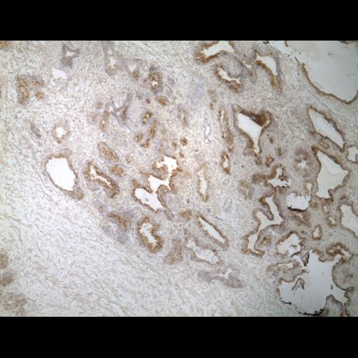  NCBI Organism:Homo sapiens; Cell Types:endocrine-paracrine cell of prostate gland, basal cell of prostate epithelium, luminal cell of prostate epithelium, blood vessel endothelial cell, perineural cell, sheath cell, leukocyte, prostate stromal cell, smooth muscle cell of prostate; Cell Components:nucleus, cell surface;