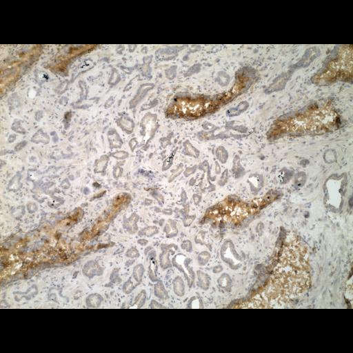  NCBI Organism:Homo sapiens; Cell Types:endocrine-paracrine cell of prostate gland, basal cell of prostate epithelium, luminal cell of prostate epithelium, blood vessel endothelial cell, perineural cell, sheath cell, leukocyte, prostate stromal cell, smooth muscle cell of prostate; Cell Components:nucleus, cell surface;