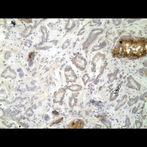  NCBI Organism:Homo sapiens; Cell Types:endocrine-paracrine cell of prostate gland, basal cell of prostate epithelium, luminal cell of prostate epithelium, blood vessel endothelial cell, perineural cell, sheath cell, leukocyte, prostate stromal cell, smooth muscle cell of prostate; Cell Components:nucleus, cell surface;