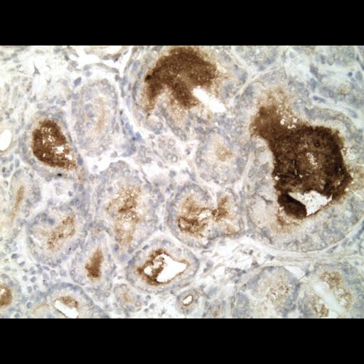  NCBI Organism:Homo sapiens; Cell Types:endocrine-paracrine cell of prostate gland, basal cell of prostate epithelium, luminal cell of prostate epithelium, blood vessel endothelial cell, perineural cell, sheath cell, leukocyte, prostate stromal cell, smooth muscle cell of prostate; Cell Components:nucleus, cell surface;