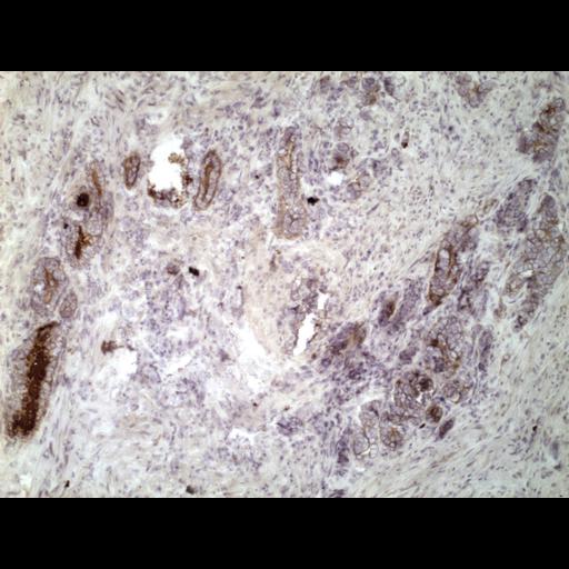  NCBI Organism:Homo sapiens; Cell Types:endocrine-paracrine cell of prostate gland, basal cell of prostate epithelium, luminal cell of prostate epithelium, blood vessel endothelial cell, perineural cell, sheath cell, leukocyte, prostate stromal cell, smooth muscle cell of prostate; Cell Components:nucleus, cell surface;