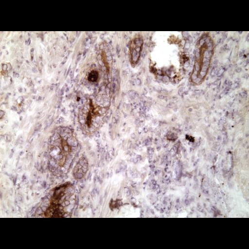  NCBI Organism:Homo sapiens; Cell Types:endocrine-paracrine cell of prostate gland, basal cell of prostate epithelium, luminal cell of prostate epithelium, blood vessel endothelial cell, perineural cell, sheath cell, leukocyte, prostate stromal cell, smooth muscle cell of prostate; Cell Components:nucleus, cell surface;