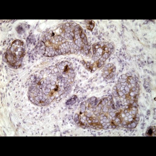  NCBI Organism:Homo sapiens; Cell Types:endocrine-paracrine cell of prostate gland, basal cell of prostate epithelium, luminal cell of prostate epithelium, blood vessel endothelial cell, perineural cell, sheath cell, leukocyte, prostate stromal cell, smooth muscle cell of prostate; Cell Components:nucleus, cell surface;