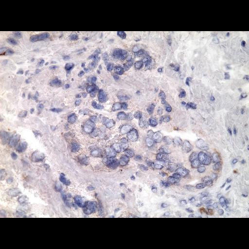  NCBI Organism:Homo sapiens; Cell Types:endocrine-paracrine cell of prostate gland, basal cell of prostate epithelium, luminal cell of prostate epithelium, blood vessel endothelial cell, perineural cell, sheath cell, leukocyte, prostate stromal cell, smooth muscle cell of prostate; Cell Components:nucleus, cell surface;