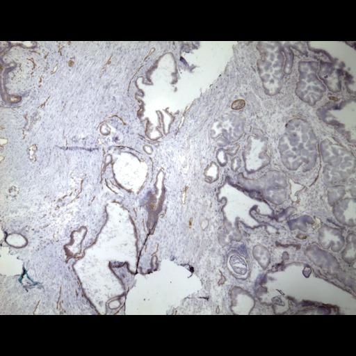  NCBI Organism:Homo sapiens; Cell Types:endocrine-paracrine cell of prostate gland, basal cell of prostate epithelium, luminal cell of prostate epithelium, blood vessel endothelial cell, perineural cell, sheath cell, leukocyte, prostate stromal cell, smooth muscle cell of prostate; Cell Components:nucleus, cell surface;